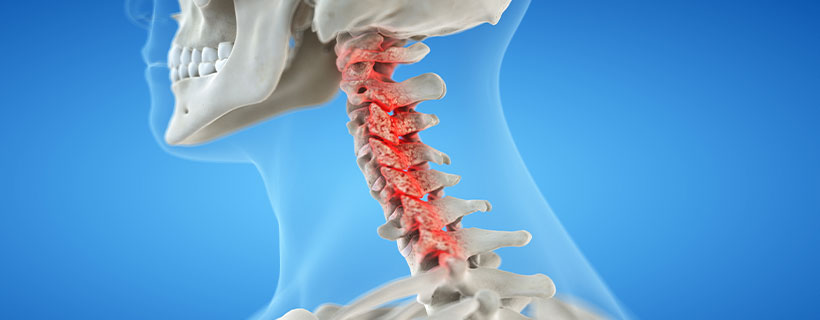 patient needing bone spur treatment in Newport Beach
