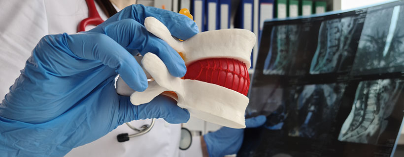 patient needing herniated disc chiropractor in Newport Beach CA